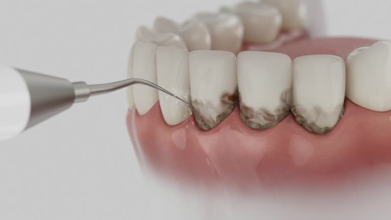 Trusted Teeth Cleaning And Checkup service in Hahnville, LA - Dentist Open Now